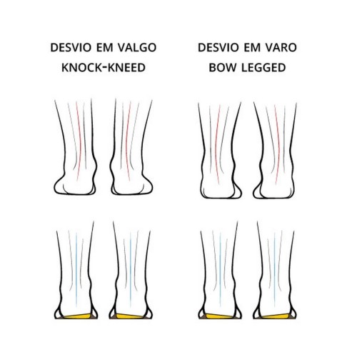 Calcanheiras Corretoras 